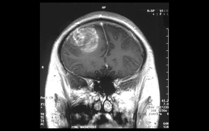 Feed Image